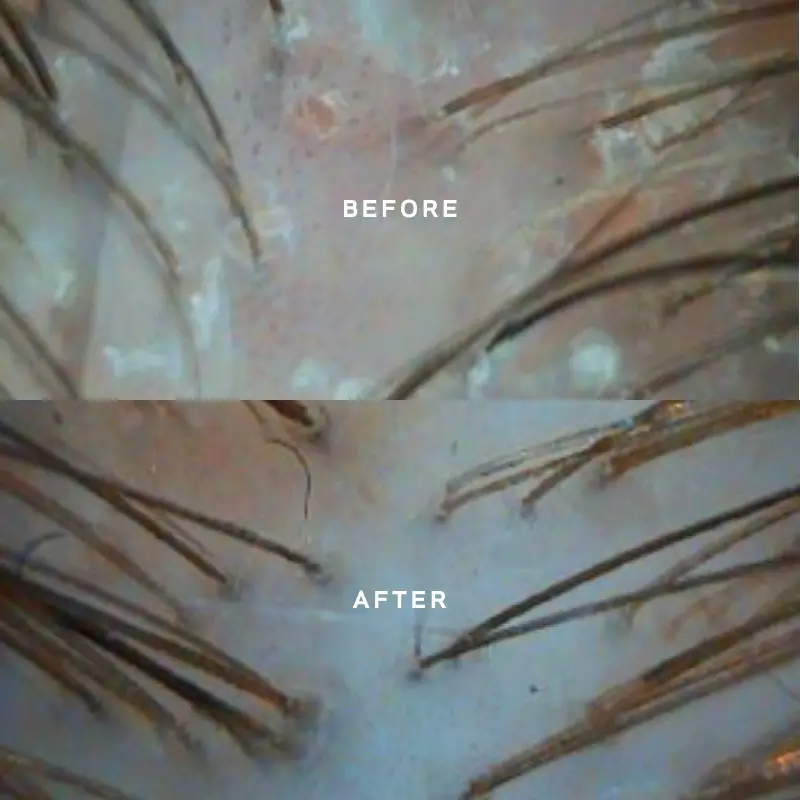 Miriam Quevedo Black Baccara Scalp Concetrate + Pre-Treatment Exfoliator 30+10ml - Image 2